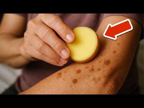 Remove age spots in 20 minutes with potato & ginger💥(Quick & Easy)🤯