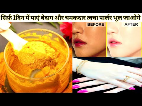 इस फेस पैक से चेहरे के दाग़ धब्बे,कील मुहांसे सिर्फ़ 1दिन में दूर करें और पाएं बेदाग और चमकदार त्वचा