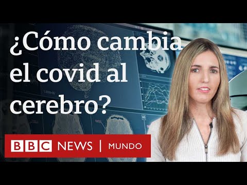 Video: Cómo cambia el cerebro tras una infección por coronavirus, aunque esta sea leve | BBC Mundo