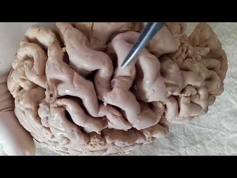 NEUROANATOMY - CEREBRAL CORTEX PART-2 FUNCTIONAL AREAS - BY DR MITESH DAVE