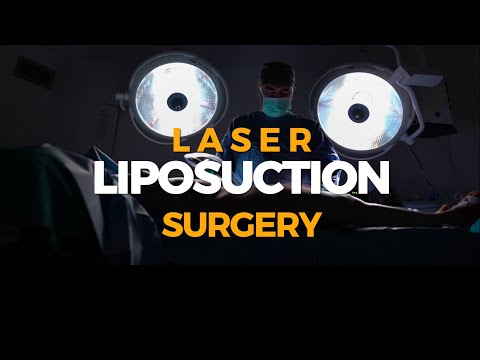 Laser Liposuction Surgery