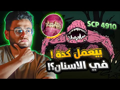 Scp 4910  يصيب الاسنان