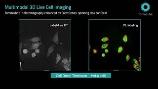 Holotomography with Spinning Disk Confocal - Tomocube HT-X1 Plus
