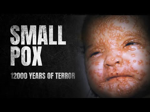 SmallPox - A Virus of the Past & How it Happened | PrepLadder Neet PG