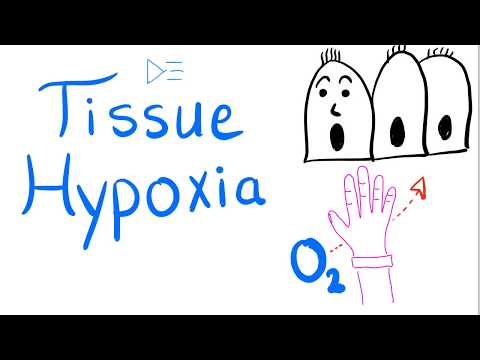 Tissue Hypoxia - Respiratory Physiology & Pathology - Pulmonary Medicine