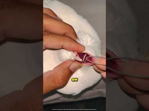 Этот парень вытащил верёвку из горла своего голубя 😱