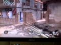 Kid Freaks Out After Being Shot