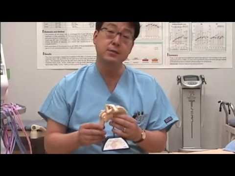 臨床現場における物理療法 第2部 肩関節周囲炎