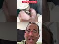 MAMMOTH INGROWN TOENAIL REMOVAL Shorts Ingrown Ingrowntoenail