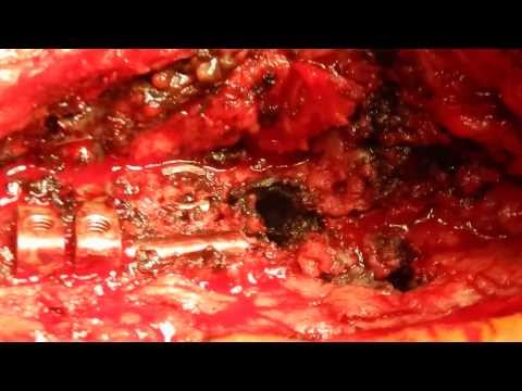 Farmaci per il dolore alle articolazioni delle dita Rimedio per il mal di schiena durante le mestruazioni