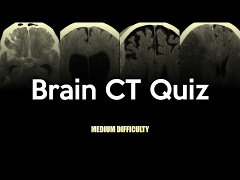 Brain CT Quiz: Medium Difficulty