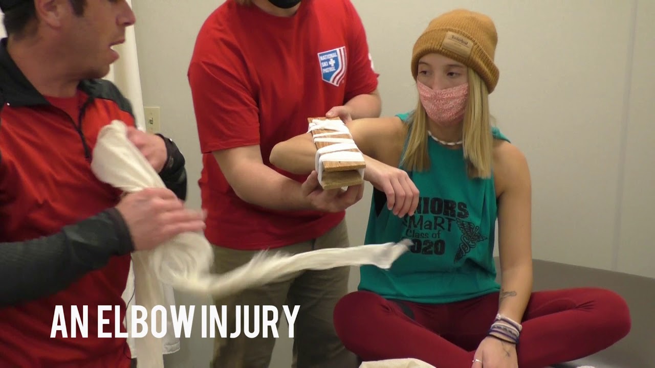 Common Splinting Techniques