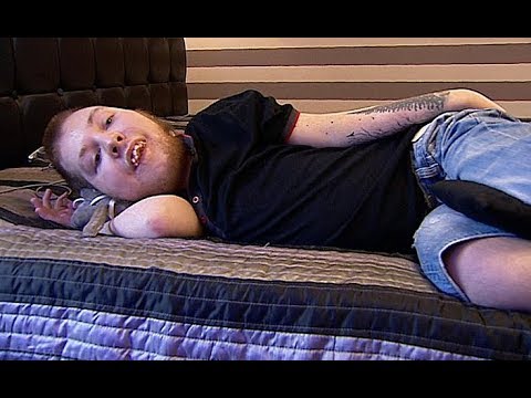 Skurcz mięśnia przepony Obrazki mięśnie przedramienia