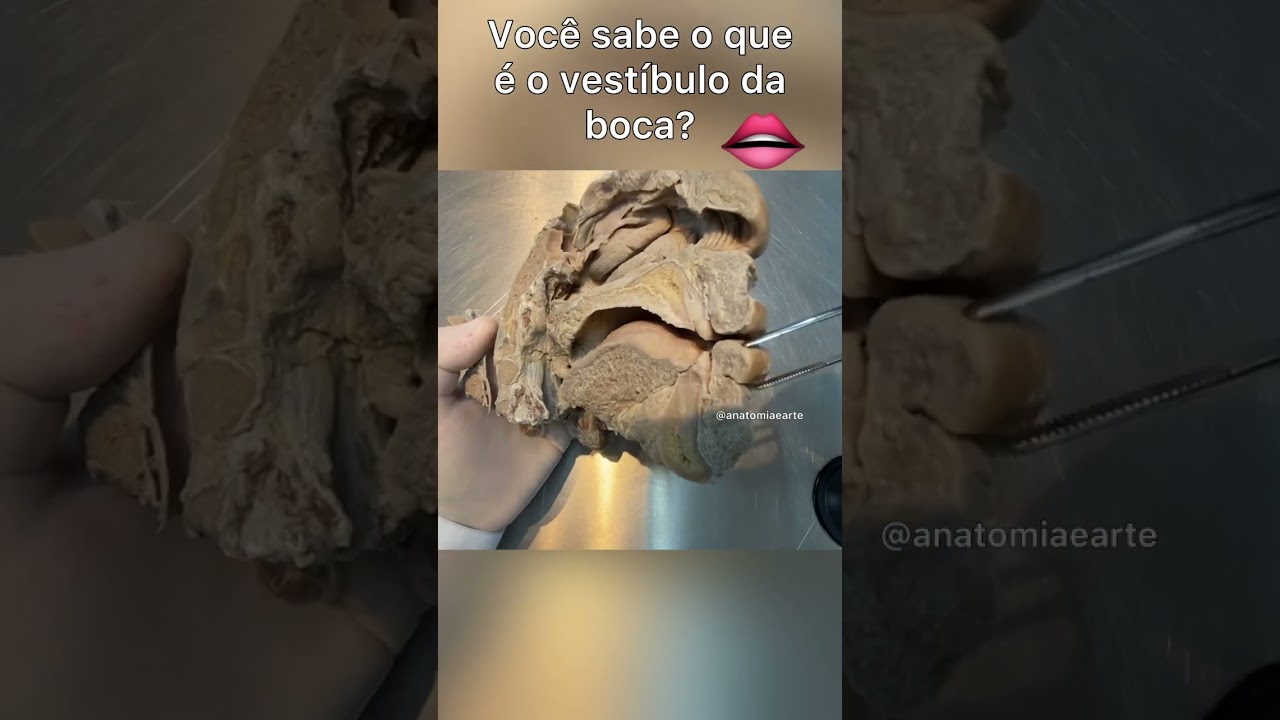 Conheça o vestíbulo da boca. #anatomy #anatomiapratica #anatomiaclinica