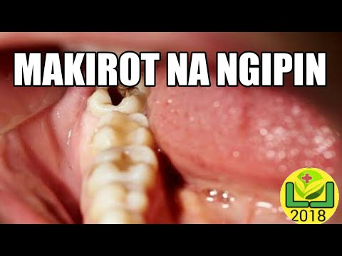 Paano alisin tiyan taba pati ng dibdib Ang lahat bude Anita Lutsenko magandang ehersisyo upang mangayayat