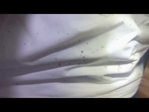 Grandma Getting Bit Up by Bed Bugs in Princeton Junction, NJ