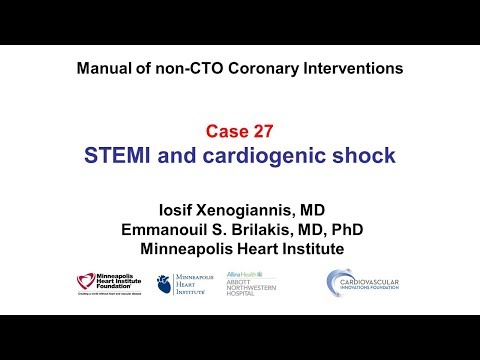 Case 27: PCI Manual: STEMI and shock