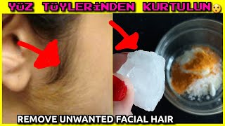 BUNU YAP ,İSTENMEYEN YÜZ TÜYLERİNDEN KALICI KURTUL- AĞDA YOK-İP YOK- LAZER YOK