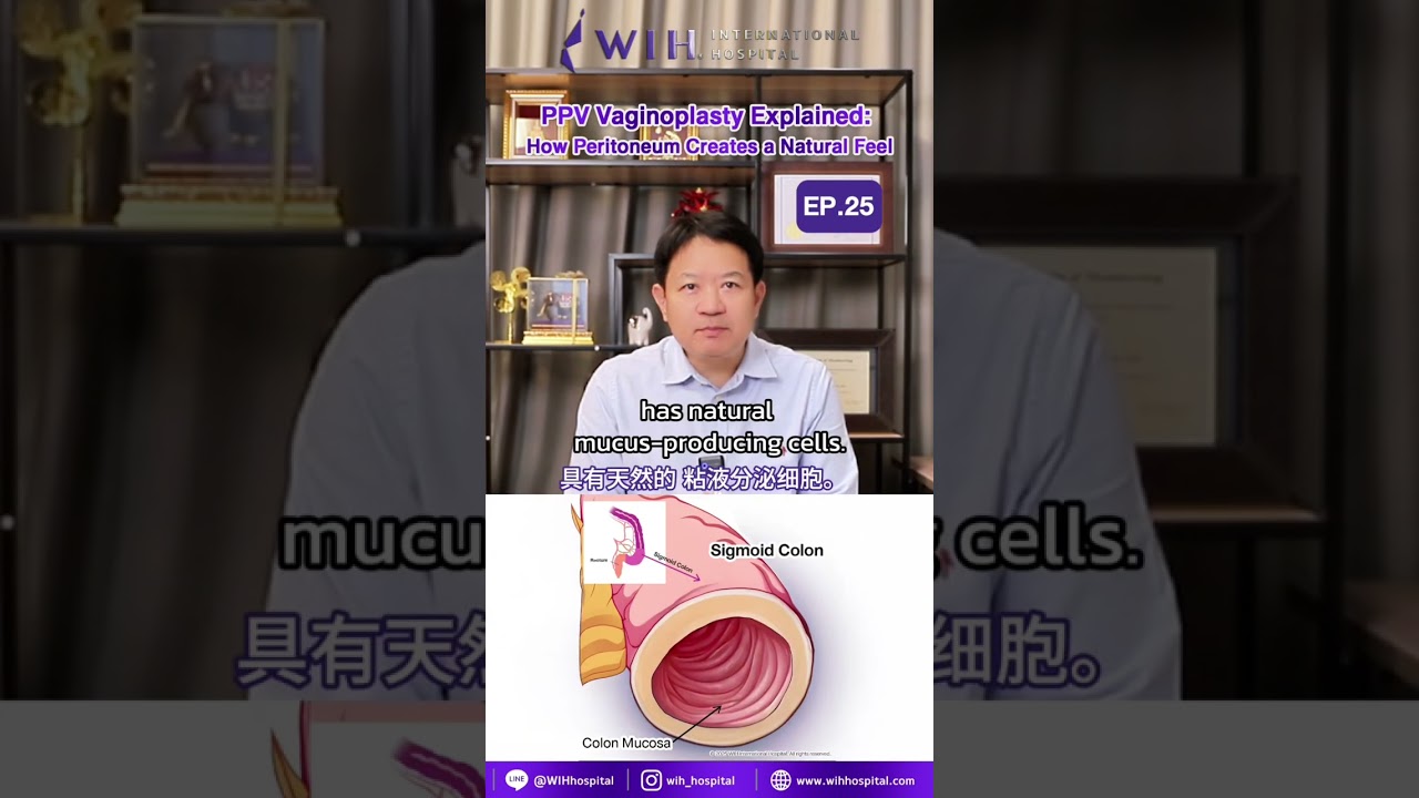 EP.25 | What is PPV Vaginoplasty? Dr. Chettasak explains Peritoneal Pull-Through Vaginoplasty