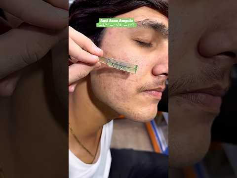 Glow & Clean Anti Acne Ampule & Tea Tree Face Wash Amazing #ameenbeautytips