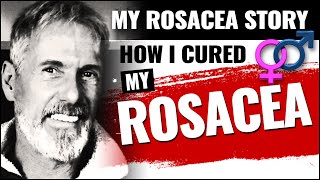 My Rosacea Story | How I Cured My Rosacea