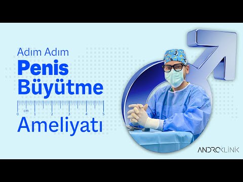 Adım Adım Penis Büyütme Ameliyatı !