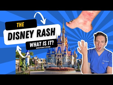Disney can give you a RASH?  Derm explains this rash Disney lovers may get! #disneyrash #disney