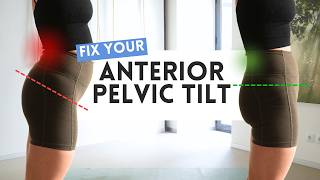 20-Min Strength + Stretch to Fix Anterior Pelvic Tilt (Relieve Back Pain & Impro