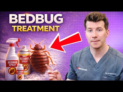 How to treat Bed Bugs | Doctor's step-by-step guide