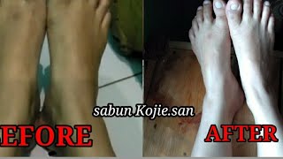 Download lagu CARA PAKAI KOJIE.SAN/REVIEW SABUN KOJIE.SAN /Pratama channel mp3