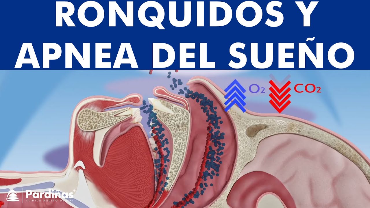 Giovanni Alvear Urzua-29