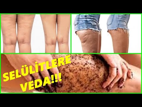 Orvosi fogyókúra - ORVOSILAG FELÜGYELT FOGYÓKÚRA, Sa egészségügyi fogyás