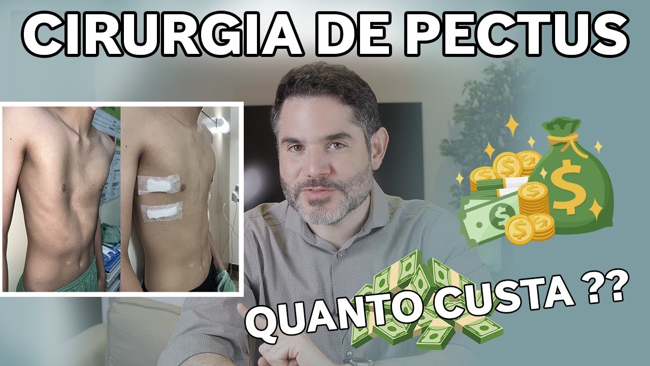 💰 QUANTO CUSTA uma cirurgia de PECTUS? 💵