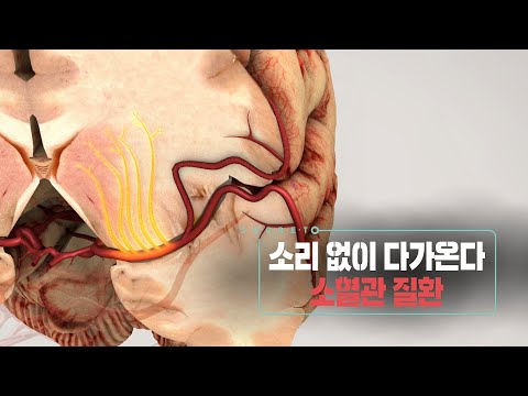 , title : '📌방송 하이라이트📌소리없이 다가온다 소혈관 질환 (KBS 20230308 방송)'