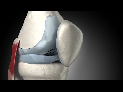 Psoriasis a beber de las articulaciones El cobro por el fortalecimiento de los músculos de la columna torácica