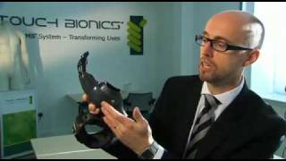 Biotecnología: manos biónicas