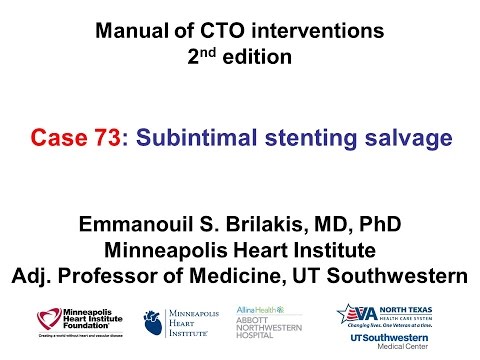 Case 73: Manual of CTO Interventions - Subintimal stenting salvage