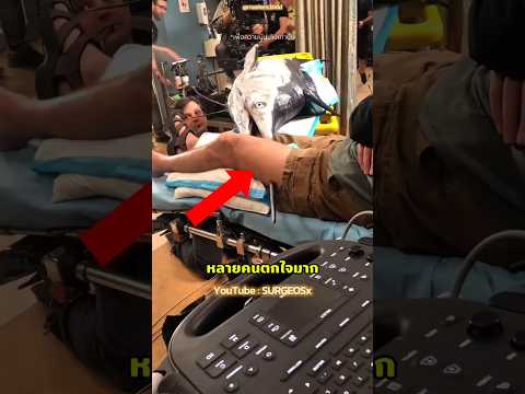 โอ้โห! มีปลาปักขาชายคนนี้😱