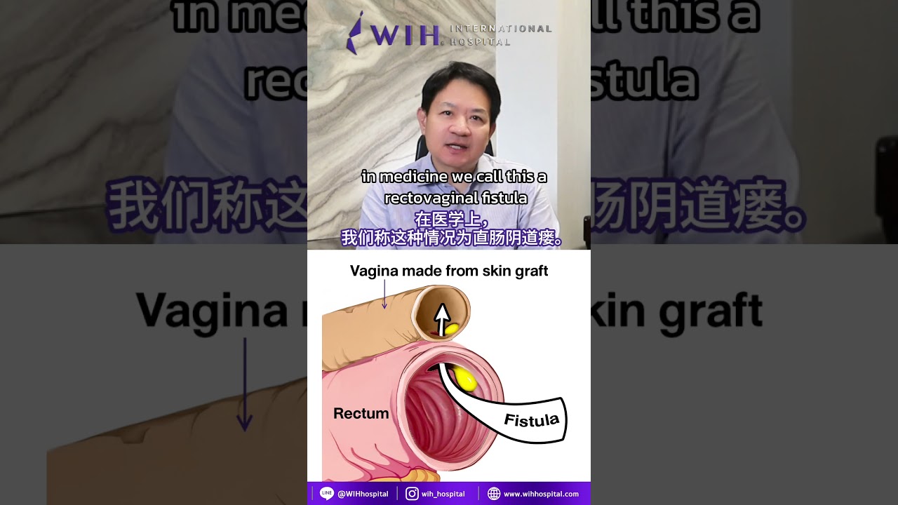Ep. 23 | Dr. Chettasak Explains Recto-Vaginal Fistula After Gender-Affirming Surgery
