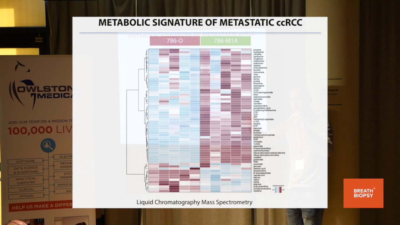 Dr Christian Frezza - Mitochondrial Dysfunction in Cancer