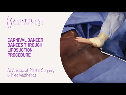 Carnival Dancer Dances through Liposuction Procedure