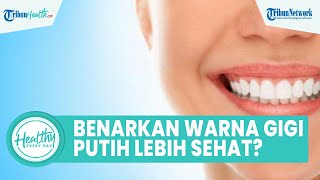 Benarkah Warna Gigi Putih Lebih Sehat? Simak Penjelasan drg Ummi Kalsum