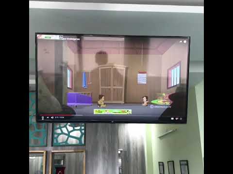 Painless root canal of a child. Visit us for all kind of dental treatments.