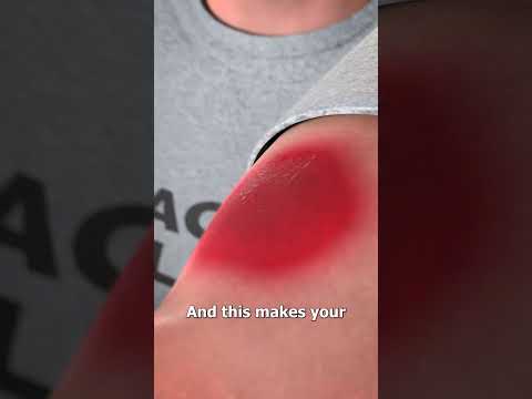 Black Widow Bites 😨 (explained)