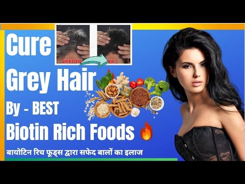 Best Biotin Rich Foods for Grey Hair Cure Fast