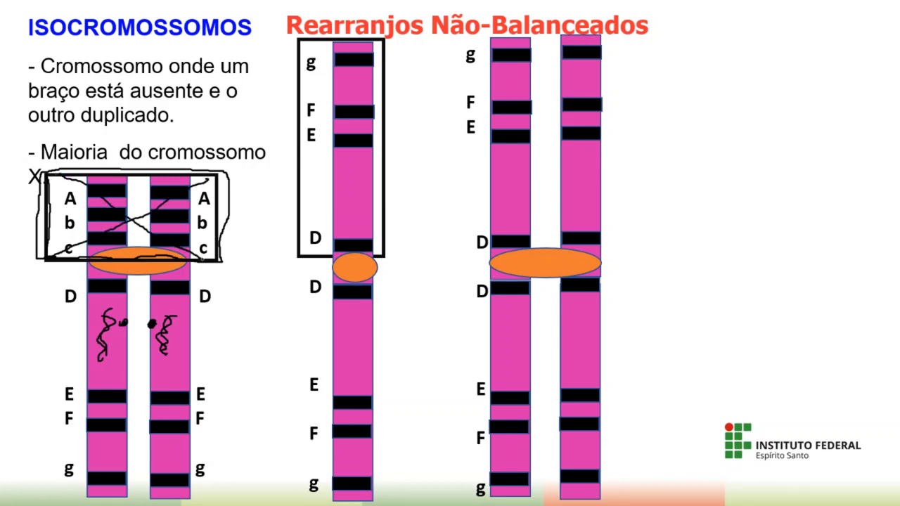 Citogenética - Alterações estruturais - translocação - trissomia parcial  - genética - humana