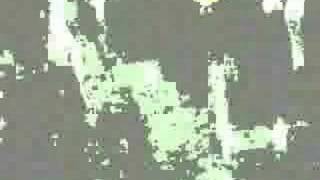 Toxic Epidermal Necrolysis