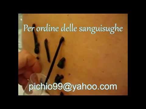 Spalla di recupero tendini congiunta Dolore persistente nella parte destra della schiena