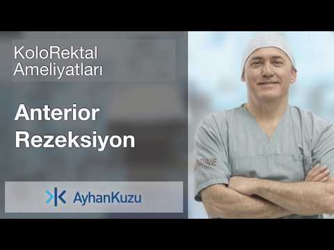 Kolorektal Ameliyatları #9 - Anterior Razeksiyon