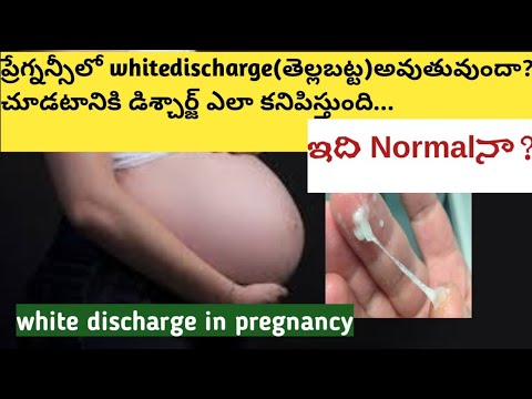 pregnancy లో వైట్ డిశ్చార్జ్ ఎందుకు అవుతుంది?white discharge in pregnancy Telugu
